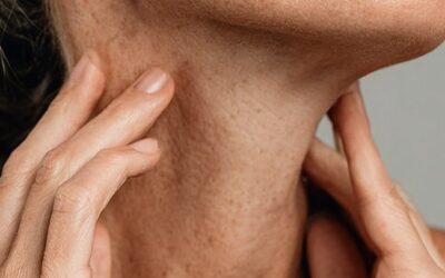 Flacidez facial y corporal: por qué aparece y cómo puedes prevenirla